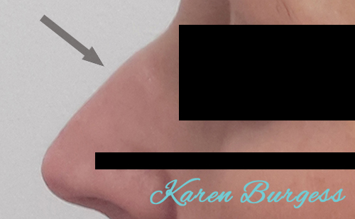 Before image