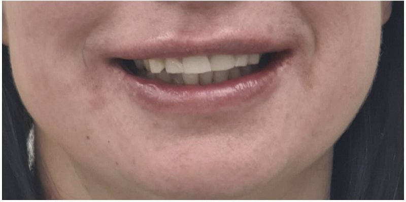 After Image
